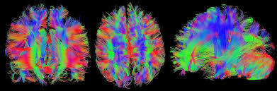 Brain